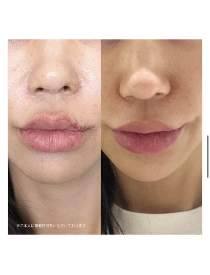 を使ったクチコミ(1枚目)