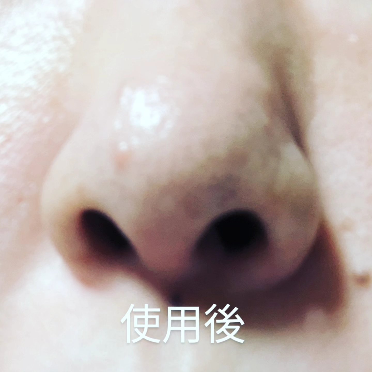 チョコブラ スペシャル毛穴ケアセット/Chocobra/スキンケアキットを使ったクチコミ（3枚目）