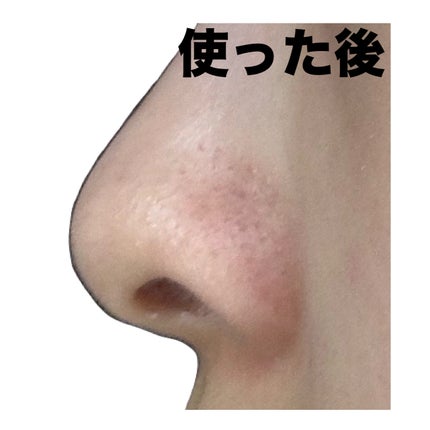 ノーズピーリングパック/One-day's you/シートマスク・パックを使ったクチコミ(5枚目)