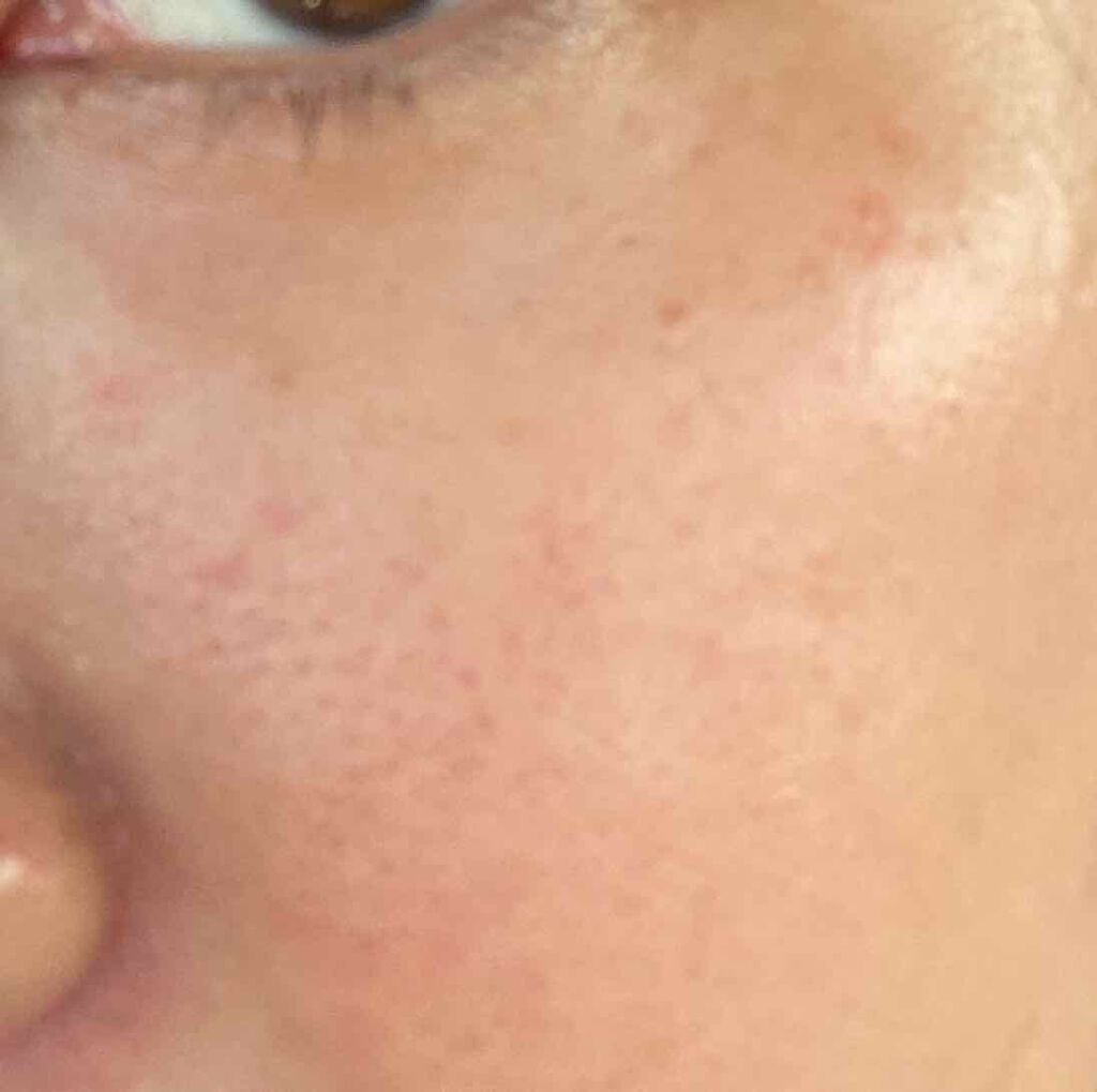 ハトムギ化粧水(ナチュリエ スキンコンディショナー R )/ナチュリエ/化粧水を使ったクチコミ(2枚目)