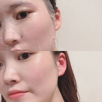 ダーマレーザースーパーVC100マスク/クオリティファースト/シートマスク・パックを使ったクチコミ(3枚目)