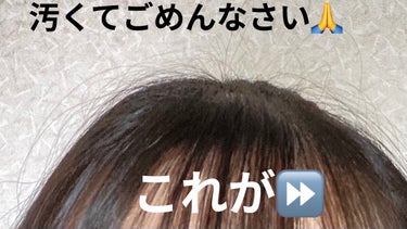 あほ毛レスキュー/キャンドゥ/ヘアバームを使ったクチコミ（2枚目）