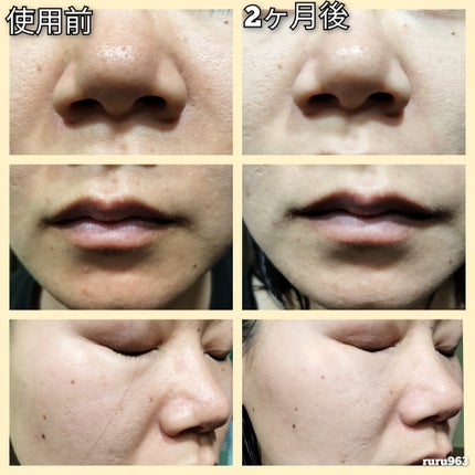 ビモラコスメ VC/BimoRa/美容液を使ったクチコミ(4枚目)