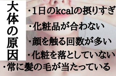 ニキビケア クリーミー泡洗顔料/ダヴ/泡洗顔を使ったクチコミ（2枚目）