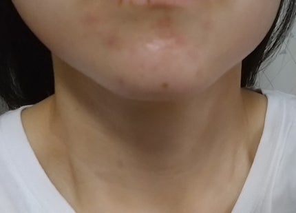 モイストバランス ローション/ACSEINE/化粧水を使ったクチコミ(4枚目)