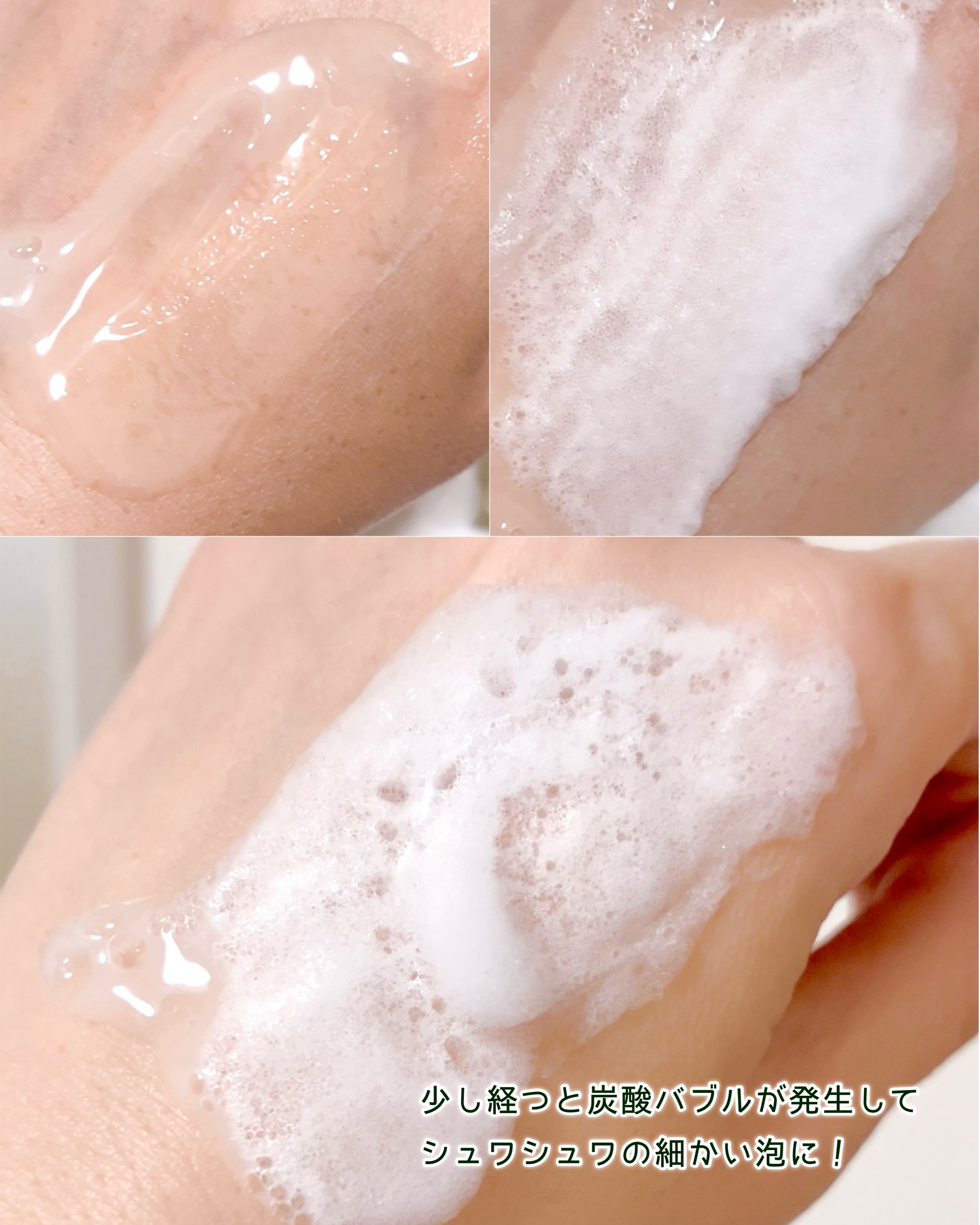 スパークリングスカルプスケーラー/ミンツリー/頭皮ケアを使ったクチコミ（3枚目）