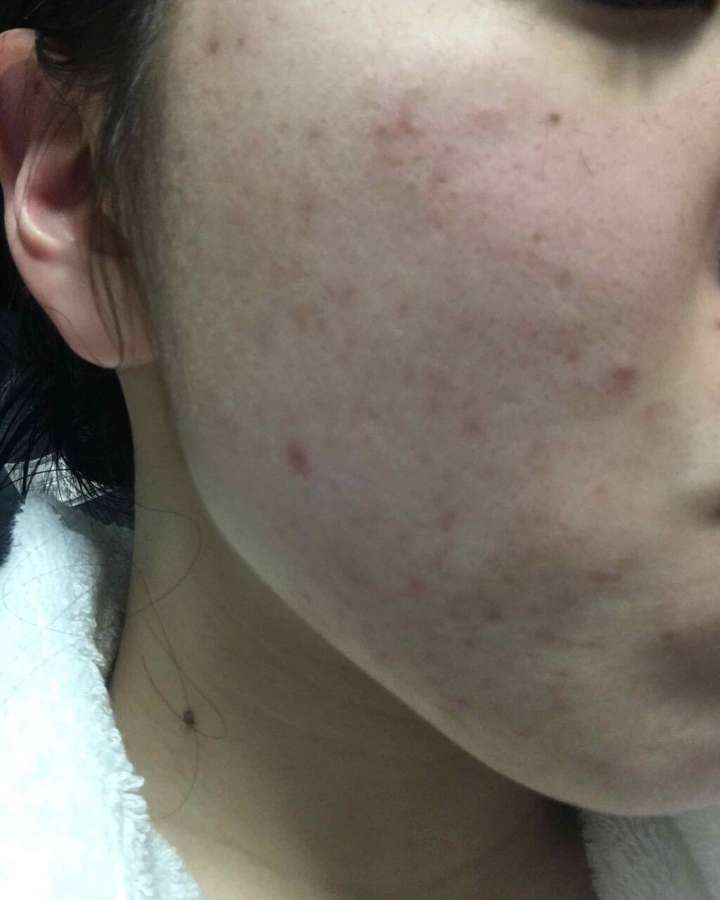 まっぷち on LIPS 「良くなってきたかも!!ぴかぴかにするぞ〜〜〜〜..」(2枚目)