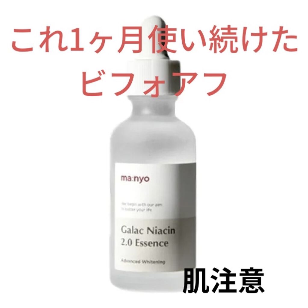 ガラクナイアシン2.0エッセンス/manyo/美容液を使ったクチコミ（1枚目）
