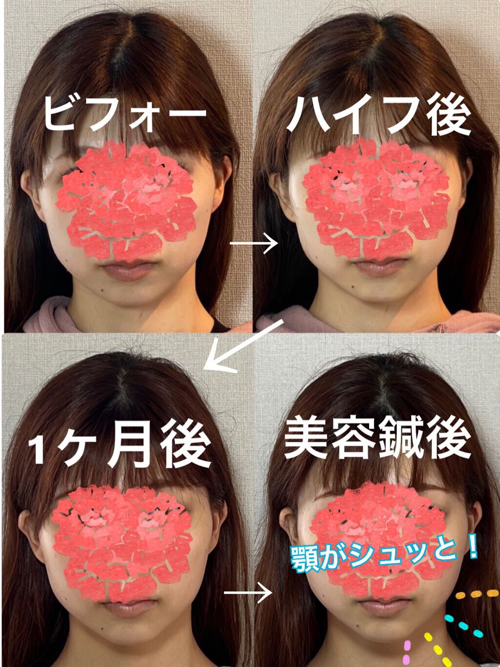 を使ったクチコミ（1枚目）