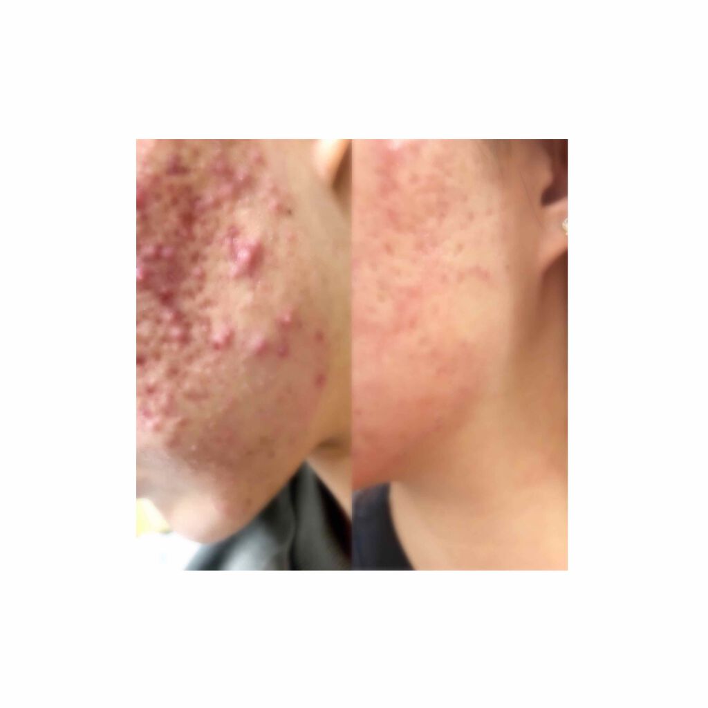 メイク落としミルク/カウブランド無添加/ミルククレンジングを使ったクチコミ(2枚目)