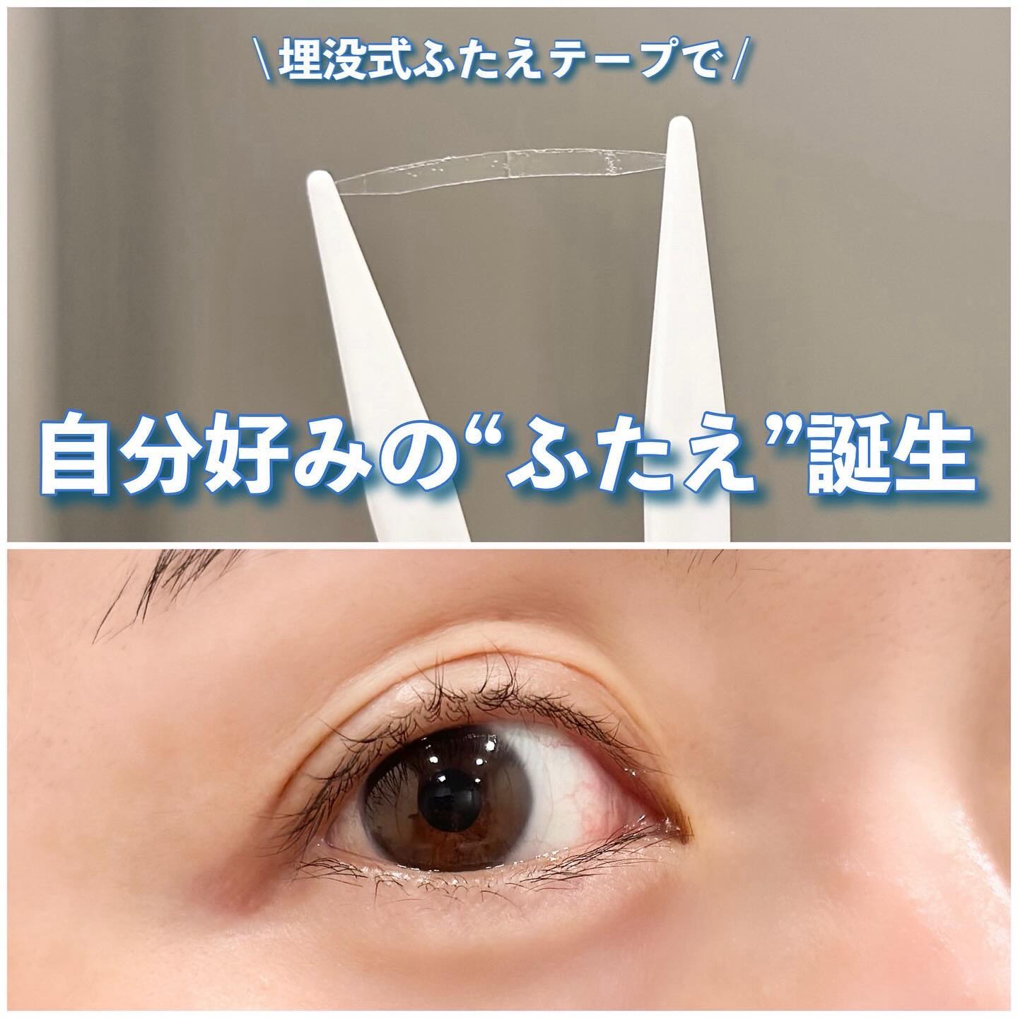 ワンダーアイリッドテープ Extra/D-UP/二重まぶた用アイテムを使ったクチコミ（1枚目）