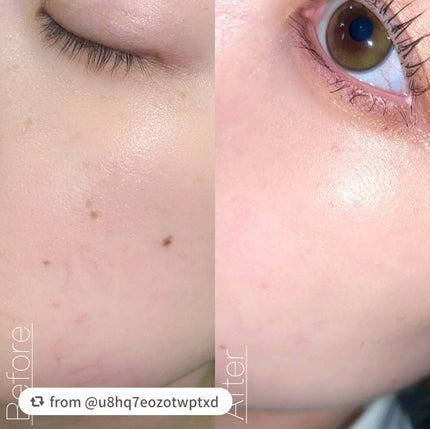 アンリミテッド ケア ツヤ セラム ファンデーション/shu uemura/リキッドファンデーションを使ったクチコミ(6枚目)