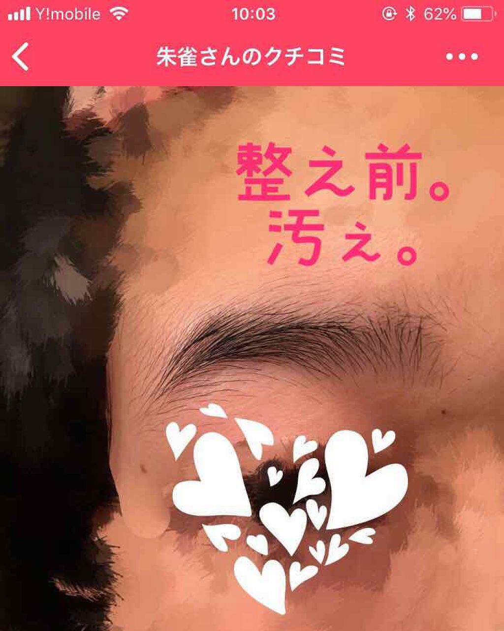 プレミア敏感肌用 Lディスポ/シック/シェーバーを使ったクチコミ(2枚目)