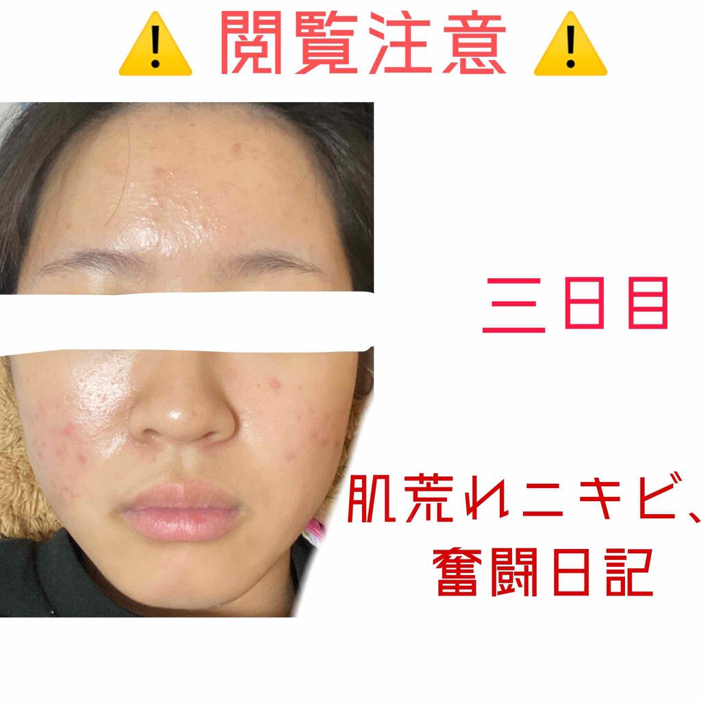 を使ったクチコミ（1枚目）