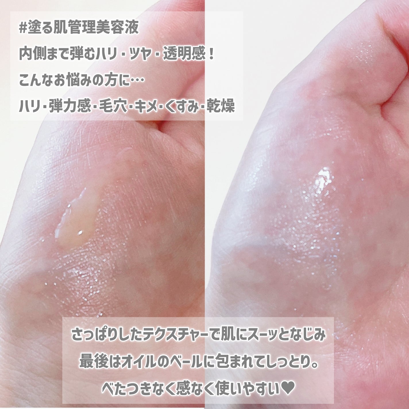 エンリッチ メディカリフト デュオセラム/ドクターシーラボⓇ/美容液を使ったクチコミ(3枚目)