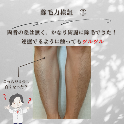 リムーバークリーム/NULL/除毛クリームを使ったクチコミ(4枚目)