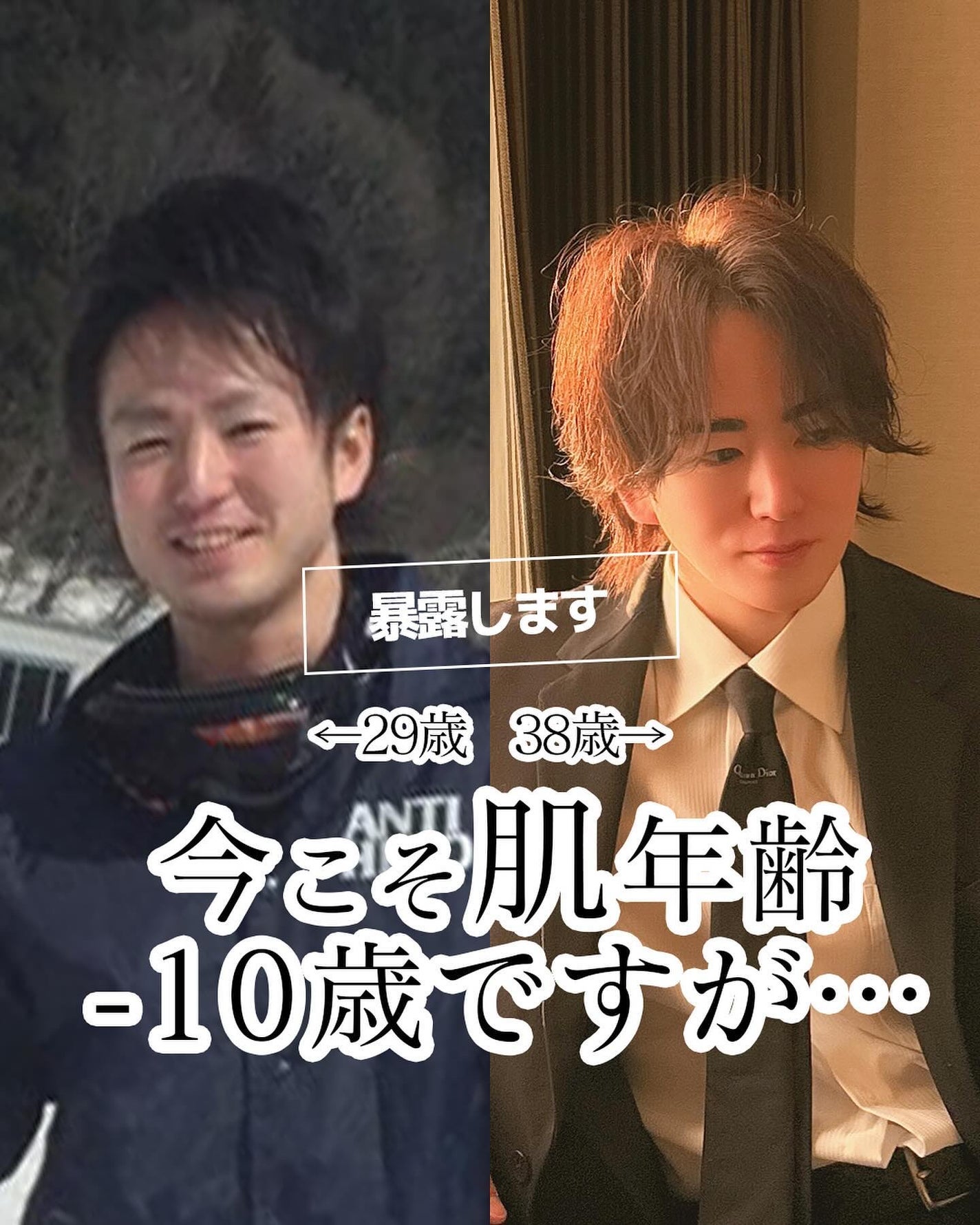 ヒロキ|40歳の美容家 ヘアケア スキンケア on LIPS 「今でこそ肌年齢マイナス10歳ですが、美容に実践してきたのが30..」(1枚目)