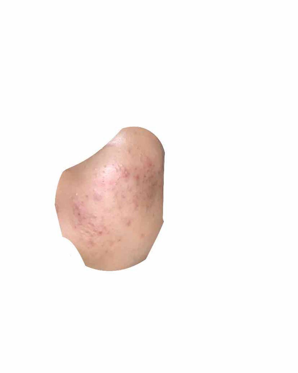 白潤 薬用美白化粧水/肌ラボ/化粧水を使ったクチコミ(2枚目)