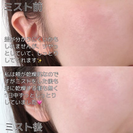 生つや肌ミスト/ウルミナプラス/美容液を使ったクチコミ(3枚目)