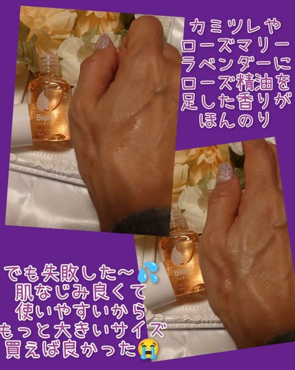 バイオイル/バイオイル/フェイスオイルを使ったクチコミ(3枚目)