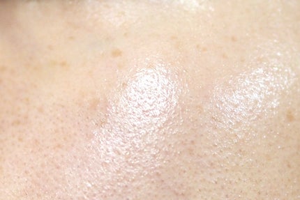 復活草ビフィダセラムファーミングドロップ/Abib /美容液を使ったクチコミ(5枚目)