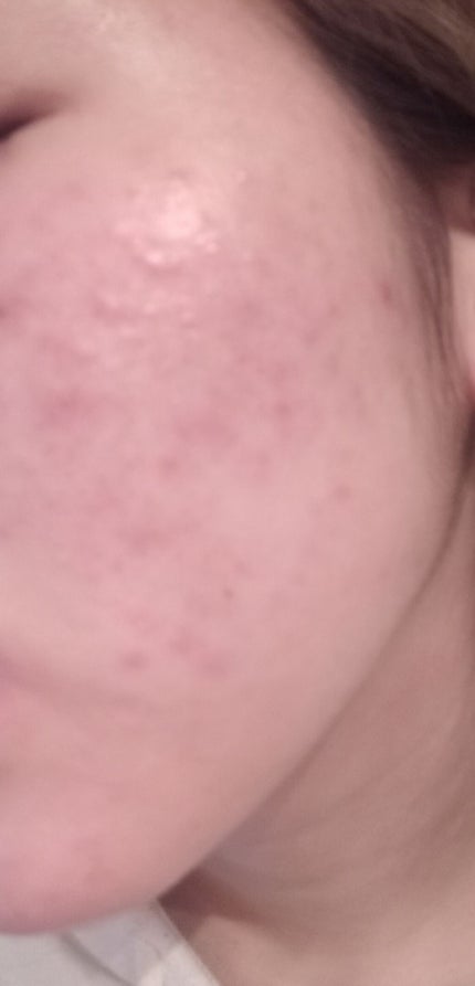 グリーンタンジェリン ビタC ダークスポットケアセラム/goodal/美容液を使ったクチコミ(2枚目)