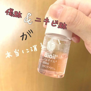 🌟投稿6回目🌟

✔小林製薬 Bioil  ¥内容量により異なる

✔小林製薬 アットノン(クリームタイプ)  ¥1100



Bioil⤵︎ ︎

🌟ちょっと匂いが気になる(ハーブ。Theハーブ)
