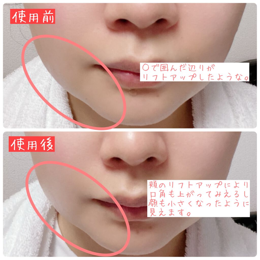 SAIBOW セラム/ドクターソワ/美容液を使ったクチコミ(3枚目)