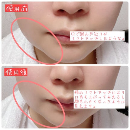 SAIBOW セラム/ドクターソワ/美容液を使ったクチコミ(3枚目)