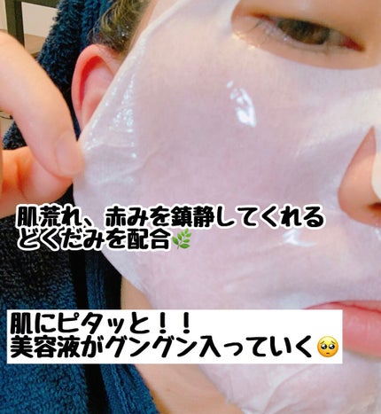 ガムシートマスクドクダミステッカー/Abib /シートマスク・パックを使ったクチコミ(2枚目)