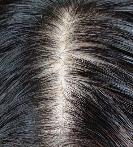 スカルプローション/Rintor/頭皮ローションを使ったクチコミ(2枚目)