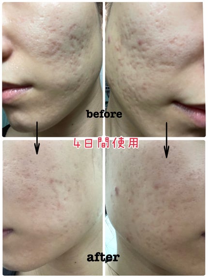 を使ったクチコミ(2枚目)