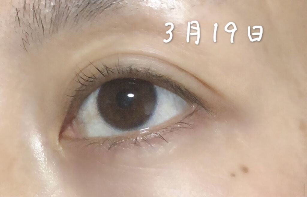 アヴァンセ ラッシュセラム EX(医薬部外品)/アヴァンセ/その他を使ったクチコミ（3枚目）