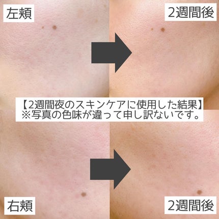 CICA エクソソーム モイスチャー マスク/VT/シートマスク・パックを使ったクチコミ(5枚目)