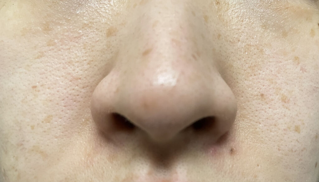 シカフルアンプル/beplain/美容液を使ったクチコミ（2枚目）