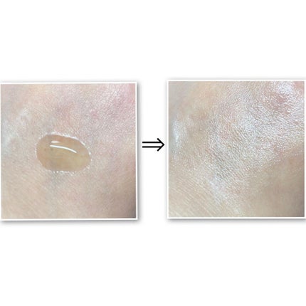 ユズナイアシンアンチブレミッシュセラム/SOME BY MI/美容液を使ったクチコミ(4枚目)