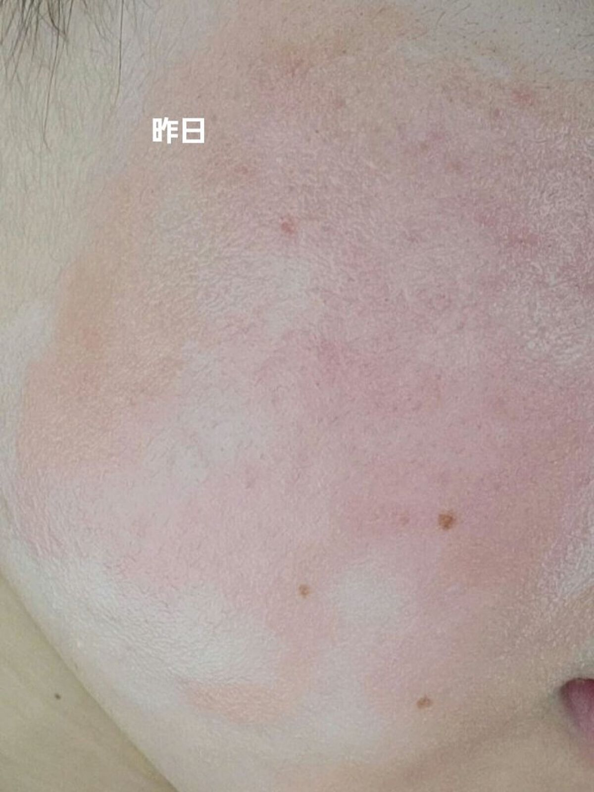 ハトムギ化粧水(ナチュリエ スキンコンディショナー R )/ナチュリエ/化粧水を使ったクチコミ（2枚目）