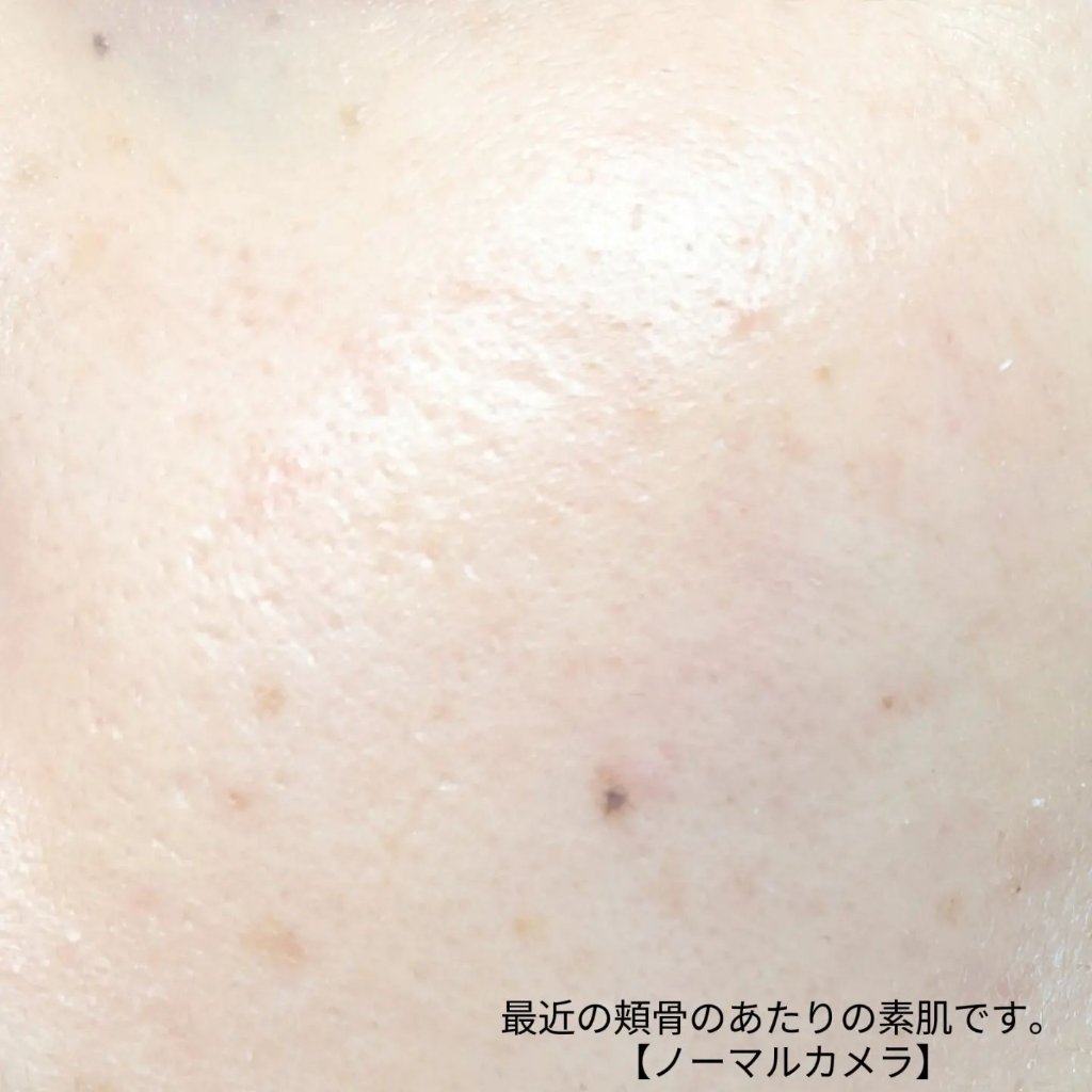 リードルショット100/VT/美容液を使ったクチコミ（3枚目）