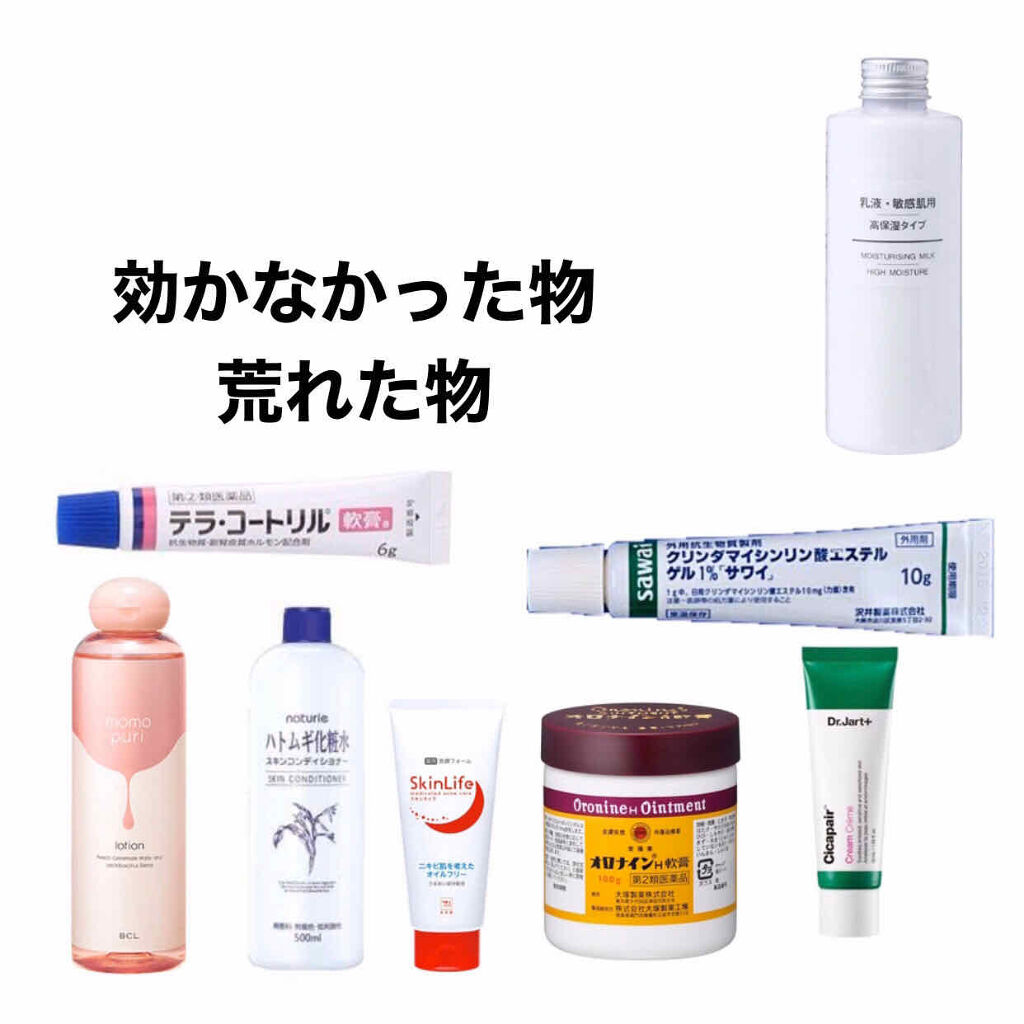 オードムーゲ 薬用ローション（ふきとり化粧水）/オードムーゲ/拭き取り化粧水を使ったクチコミ（3枚目）