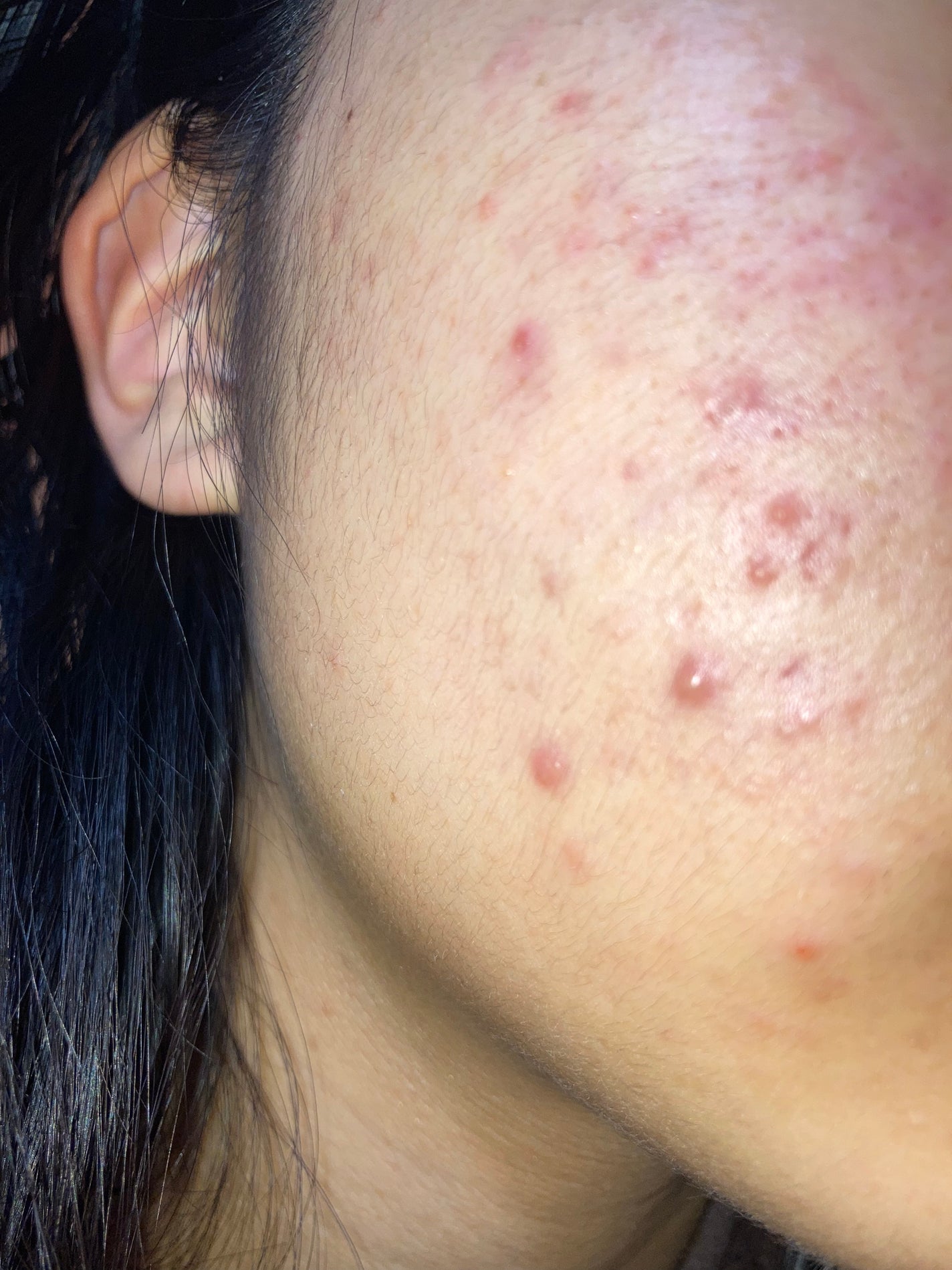 化粧水・敏感肌用・しっとりタイプ/無印良品/化粧水を使ったクチコミ(5枚目)