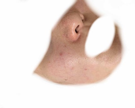 ウオーター/アベンヌ/ミスト状化粧水を使ったクチコミ(2枚目)