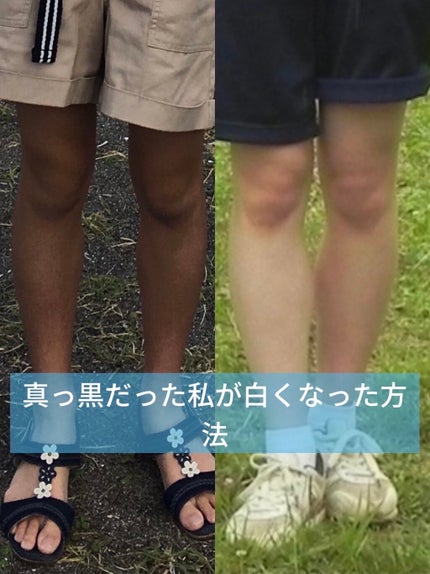 ハトムギ化粧水(ナチュリエ スキンコンディショナー R )/ナチュリエ/化粧水を使ったクチコミ(1枚目)