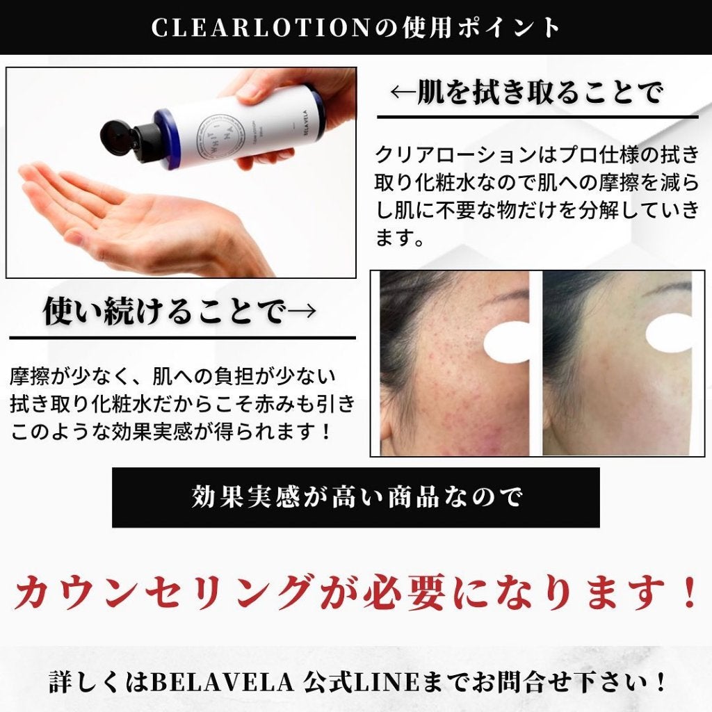 BELA VELA on LIPS 「ふきとり化粧水『WHITINACLEARLOTION』ホワイ..」(3枚目)