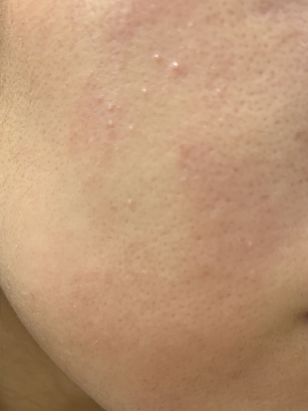 ドクダミ 77 スージングトナー/Anua/化粧水を使ったクチコミ（2枚目）