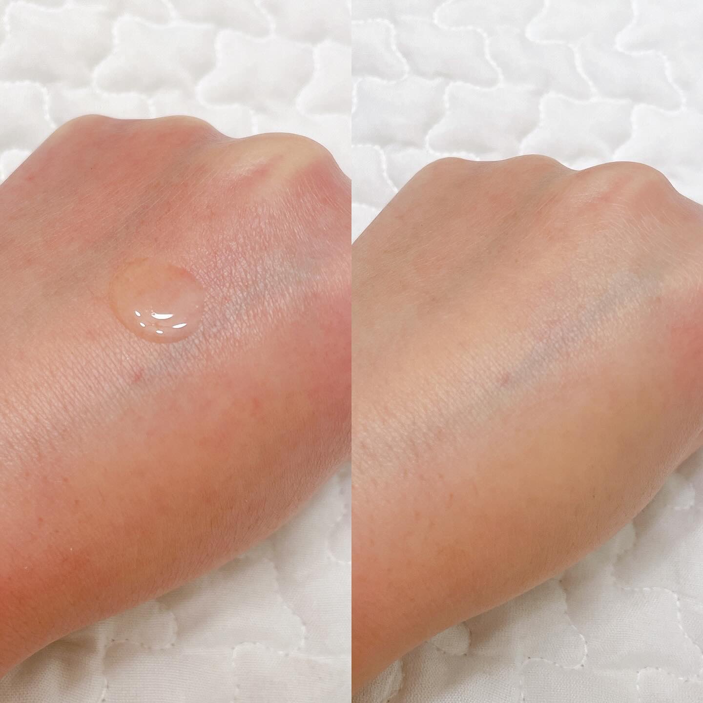 131 ポア クリアリング セラム/Celladix/美容液を使ったクチコミ（2枚目）