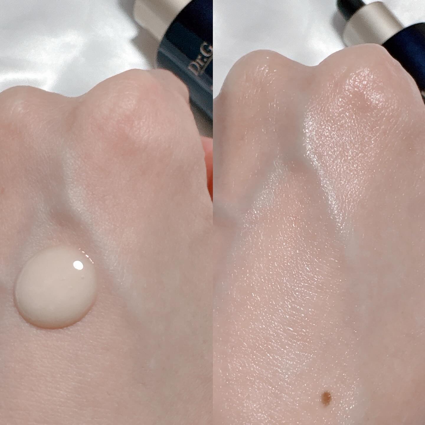 ブラックスネイル クリーム/Dr.G/フェイスクリームを使ったクチコミ（3枚目）