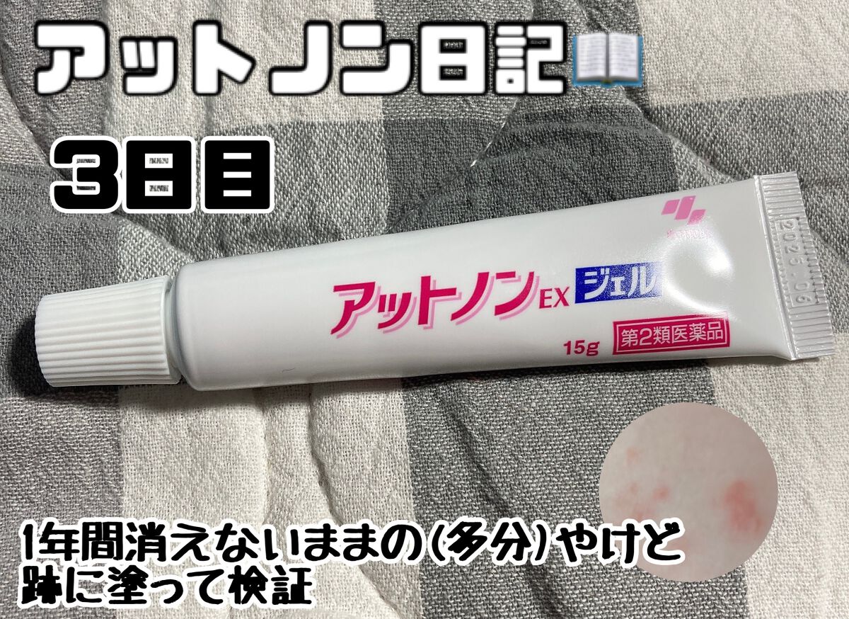 アットノンEX ジェル(医薬品)/アットノン/その他を使ったクチコミ(1枚目)