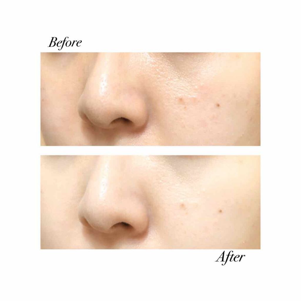 ホワイトニングトーンアップエッセンス/スノービューティー/化粧下地を使ったクチコミ(4枚目)