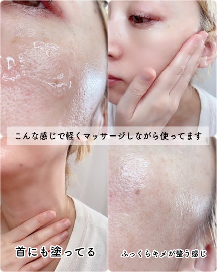 ピンクティーツリーシナジーセラム/APLIN/美容液を使ったクチコミ(5枚目)