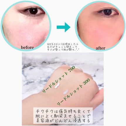 リードルショット300/VT/美容液を使ったクチコミ(4枚目)